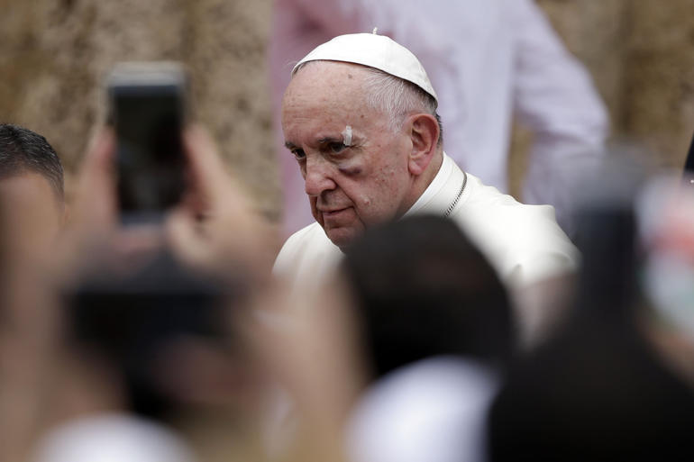 AP Photo/Ricardo Mazalan)
