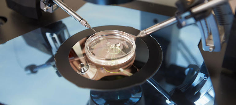 IVF Treatment