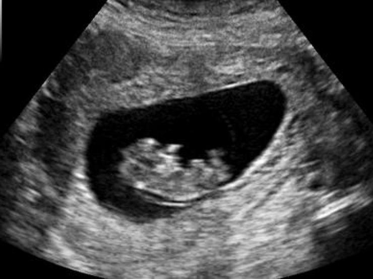 abortion-main_article_image.jpg