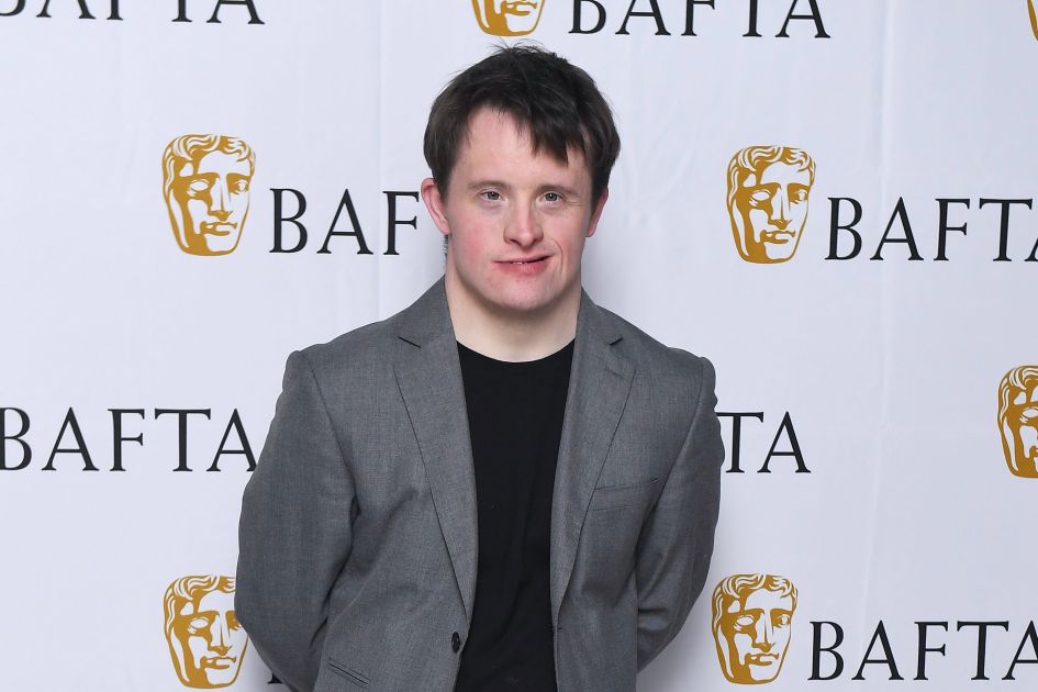Line of Duty actor with Down's syndrome backs new Down's syndrome ...