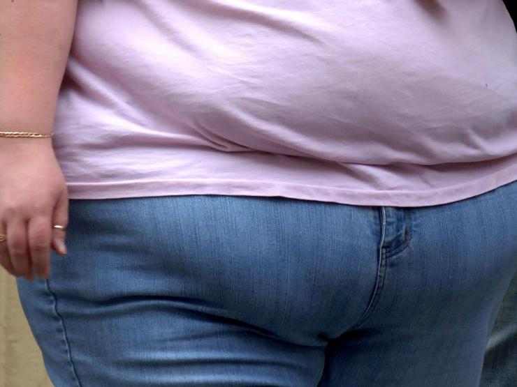 obesity.jpg