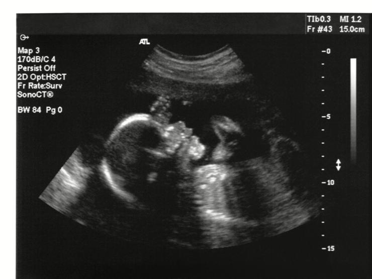 high res baby scan abortion.jpg