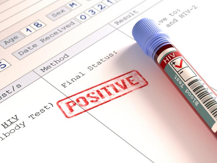 HIV PHOTO.jpg