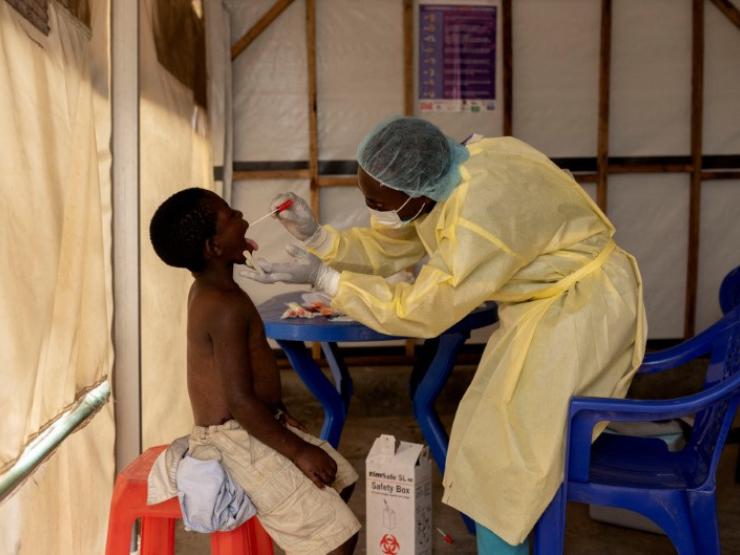 Mpox pic.JPG